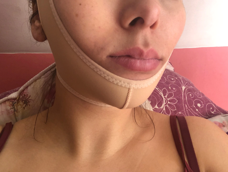 Gaine visage  - Adieu le Double menton en 15 JOURS